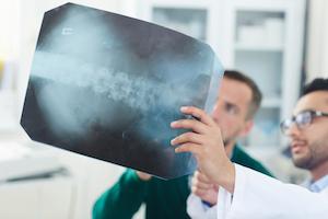 Miami Spinal Fusion Accident Attorney